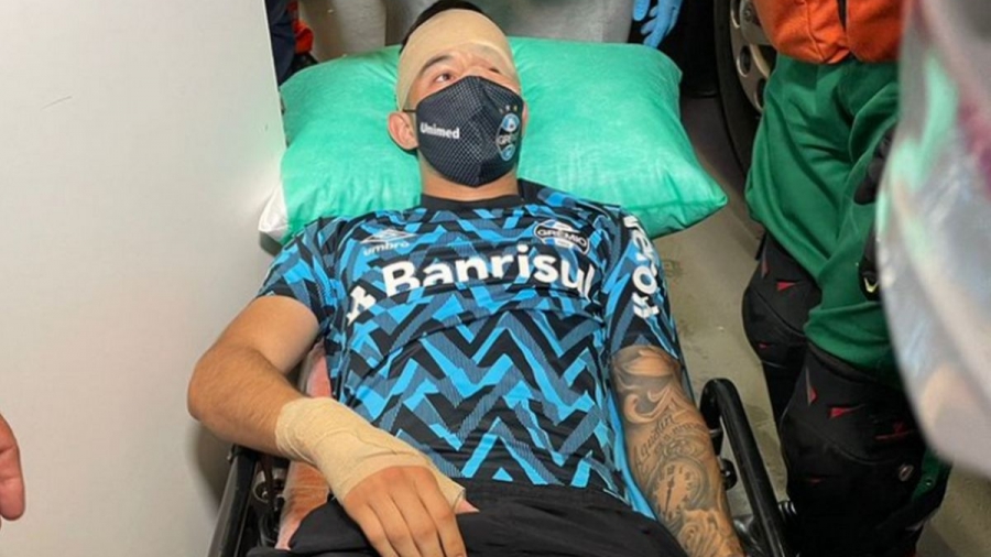 Σοκ στη Βραζιλία: Χούλιγκαν της Ιντερντασιονάλ επιτέθηκαν στο πούλμαν της Γκρέμιο και τραυμάτισαν παίκτες!