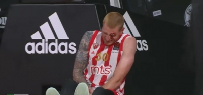 Παναθηναϊκός - Ερυθρός Αστέρας: Σοκαριστικός τραυματισμός για τον Άαρον Ουάιτ που γέμισε αίματα! (video)