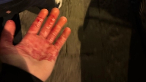 Δυο οπαδοί της Τσέλσι μαχαιρώθηκαν στη Νάπολη (pic)