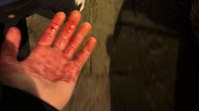 Δυο οπαδοί της Τσέλσι μαχαιρώθηκαν στη Νάπολη! (pic)