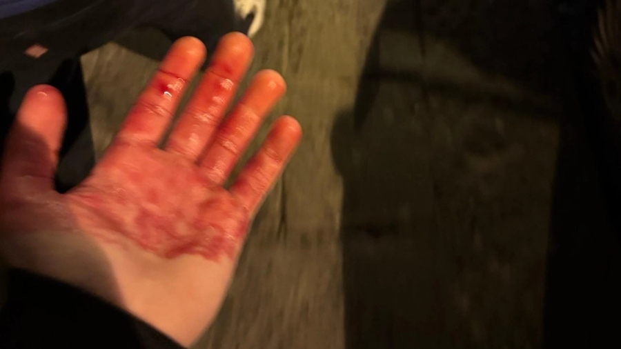 Δυο οπαδοί της Τσέλσι μαχαιρώθηκαν στη Νάπολη (pic)