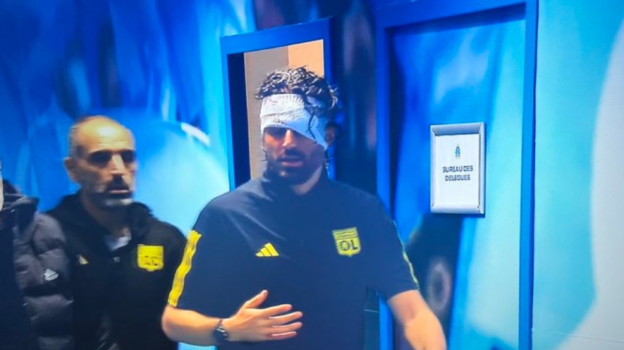 Γκρόσο για τα επεισόδια: «Θα ήθελα το πρόσωπό μου να μην κάνει τον γύρο του κόσμου»