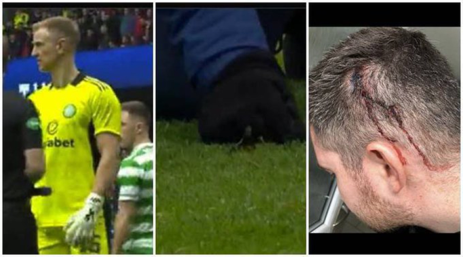 Φυλάκιση σε οπαδό της Ρέιντζερς, για ρίψη μπουκαλιού σε μέλος του τιμ της Σέλτικ (video)