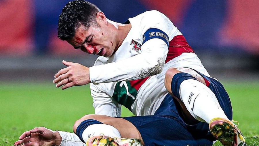 Σύγκρουση Κριστιάνο Ρονάλντο – Βάτσλικ, γέμισε αίματα ο Πορτογάλος! (video)