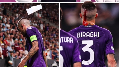 Πρόεδρος Φιορεντίνα: «Μίλησα με την Premier League, είναι ζώα οι οπαδοί»!