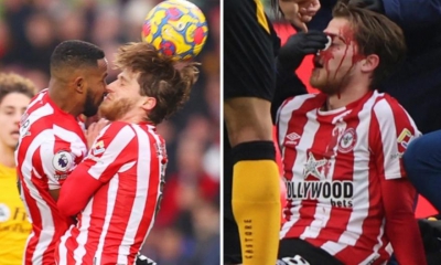 Με αίματα στο πρόσωπο ο Γένσεν της Μπρέντφορντ μετά από σοκαριστική σύγκρουση με συμπαίκτη του