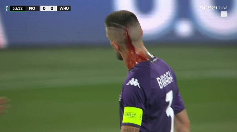 Μάτωσε στο κεφάλι ο Μπιράγκι από αντικείμενο των οπαδών της Γουέστ Χαμ (video)