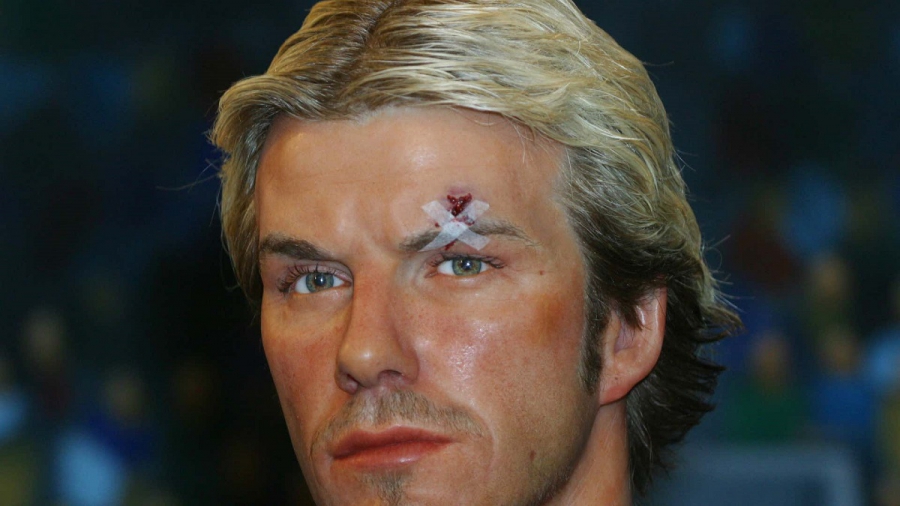 «Κάτσε κάτω!»: Το «μπανταρισμένο» φρύδι του Μπέκαμ, από το... παπούτσι του Σερ Άλεξ Φέργκιουσον (video)