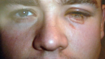 Τι μας δίνουν ο Τζο Μπάρτον και ο Τζέιμι Τάντι στο ίδιο δωμάτιο; Μια φλεγόμενη μπλούζα και ένα καμένο... μάτι!